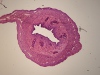 Rat uterus